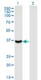 Integrin Subunit Beta 1 Binding Protein 2 antibody, MA5-21660, Invitrogen Antibodies, Western Blot image 