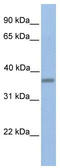 EMI Domain Containing 1 antibody, TA342105, Origene, Western Blot image 