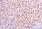 Metastasis Associated 1 antibody, orb11044, Biorbyt, Immunohistochemistry paraffin image 