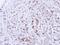 Serine/threonine-protein kinase Nek4 antibody, GTX102826, GeneTex, Immunohistochemistry paraffin image 