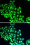 ERCC Excision Repair 2, TFIIH Core Complex Helicase Subunit antibody, LS-C346091, Lifespan Biosciences, Immunofluorescence image 