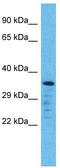 Olfactory Receptor Family 5 Subfamily L Member 2 antibody, TA337533, Origene, Western Blot image 
