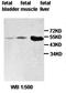 Zinc finger and BTB domain-containing protein 25 antibody, orb77729, Biorbyt, Western Blot image 