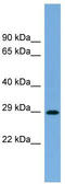 Ras-related protein Rab-40C antibody, TA344734, Origene, Western Blot image 