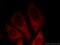 Catenin Delta 1 antibody, 12180-1-AP, Proteintech Group, Immunofluorescence image 