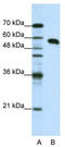 Non-POU Domain Containing Octamer Binding antibody, TA343778, Origene, Western Blot image 