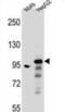 Rho GTPase Activating Protein 27 antibody, abx026864, Abbexa, Western Blot image 