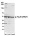DNA-directed RNA polymerase I subunit RPA49 antibody, A304-834A, Bethyl Labs, Western Blot image 