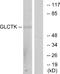 Glycerate Kinase antibody, A30520, Boster Biological Technology, Western Blot image 