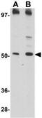 Matrilin 3 antibody, GTX85288, GeneTex, Western Blot image 