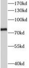 Solute Carrier Family 34 Member 2 antibody, FNab07952, FineTest, Western Blot image 