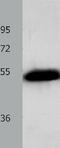 ADRB2 antibody, TA323757, Origene, Western Blot image 