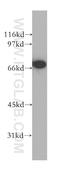 Catenin Beta Like 1 antibody, 13665-1-AP, Proteintech Group, Western Blot image 