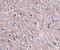 Cell Death Inducing P53 Target 1 antibody, NBP1-76993, Novus Biologicals, Immunohistochemistry paraffin image 