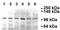 Lysosomal Associated Membrane Protein 2 antibody, ab13524, Abcam, Western Blot image 