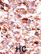 AarF Domain Containing Kinase 5 antibody, 62-665, ProSci, Immunohistochemistry paraffin image 