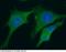 Calcyclin antibody, 10939-MM03, Sino Biological, Immunohistochemistry frozen image 