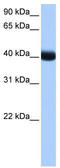 Casein Kinase 1 Gamma 3 antibody, TA340050, Origene, Western Blot image 
