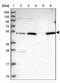 von Willebrand factor C and EGF domain-containing protein antibody, NBP2-30467, Novus Biologicals, Western Blot image 