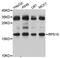 Ribosomal Protein S15 antibody, A5938, ABclonal Technology, Western Blot image 