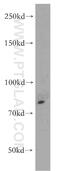 TNF Receptor Superfamily Member 1B antibody, 19272-1-AP, Proteintech Group, Western Blot image 