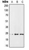 Protein Phosphatase 1 Regulatory Inhibitor Subunit 1A antibody, GTX55217, GeneTex, Western Blot image 
