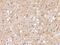 SP110 Nuclear Body Protein antibody, A03354, Boster Biological Technology, Immunohistochemistry frozen image 