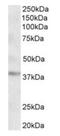 Growth Hormone Inducible Transmembrane Protein antibody, orb20474, Biorbyt, Western Blot image 