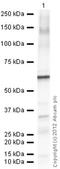 Protein Phosphatase 3 Catalytic Subunit Alpha antibody, ab3673, Abcam, Western Blot image 