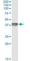 C4b-binding protein beta chain antibody, LS-C196783, Lifespan Biosciences, Immunoprecipitation image 