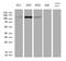 PMS1 Homolog 1, Mismatch Repair System Component antibody, MA5-27297, Invitrogen Antibodies, Western Blot image 