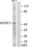 Ribosomal RNA-processing protein 8 antibody, PA5-39097, Invitrogen Antibodies, Western Blot image 