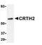 CD294 antibody, GTX42114, GeneTex, Western Blot image 
