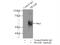 Preferentially Expressed Antigen In Melanoma antibody, 11438-1-AP, Proteintech Group, Immunoprecipitation image 