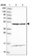 Dolichyl-diphosphooligosaccharide--protein glycosyltransferase 48 kDa subunit antibody, NBP2-38560, Novus Biologicals, Western Blot image 