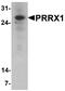 Paired mesoderm homeobox protein 1 antibody, A04774, Boster Biological Technology, Western Blot image 