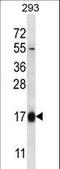 Hemoglobin Subunit Theta 1 antibody, LS-C166805, Lifespan Biosciences, Western Blot image 