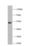 ETS Proto-Oncogene 1, Transcription Factor antibody, FNab02878, FineTest, Western Blot image 