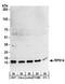 40S ribosomal protein S14 antibody, A304-031A, Bethyl Labs, Western Blot image 