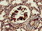 AKT1 Substrate 1 antibody, CSB-PA836185LA01HU, Cusabio, Immunohistochemistry paraffin image 