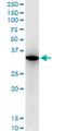 Retinoic Acid Receptor Responder 1 antibody, H00005918-M06, Novus Biologicals, Western Blot image 