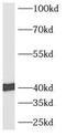 AUP1 Lipid Droplet Regulating VLDL Assembly Factor antibody, FNab00745, FineTest, Western Blot image 