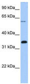 F-Box Protein 16 antibody, TA337799, Origene, Western Blot image 