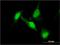 Dihydropyrimidinase Like 2 antibody, H00001808-M01, Novus Biologicals, Immunocytochemistry image 
