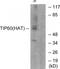 Histone acetyltransferase KAT5 antibody, TA315070, Origene, Western Blot image 