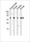 3-Hydroxy-3-Methylglutaryl-CoA Synthase 2 antibody, GTX81715, GeneTex, Western Blot image 