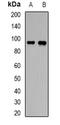 ATP Binding Cassette Subfamily C Member 4 antibody, orb340833, Biorbyt, Western Blot image 