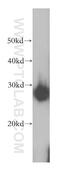 Heat shock protein beta-1 antibody, 18284-1-AP, Proteintech Group, Western Blot image 