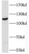 PPFIA Binding Protein 1 antibody, FNab06672, FineTest, Western Blot image 