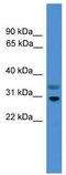Regulator Of G Protein Signaling 18 antibody, TA329536, Origene, Western Blot image 